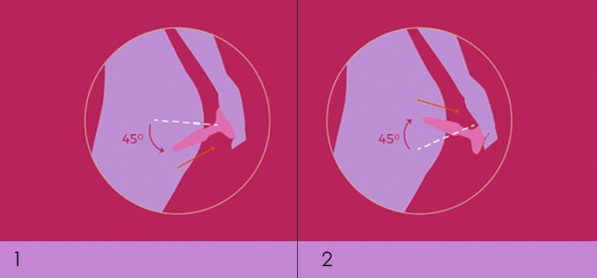 извлечение анальной пробки