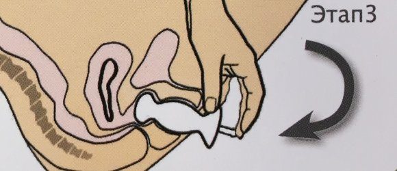 3 этап