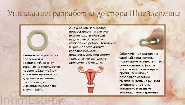 пессарий доктора шнейдермана