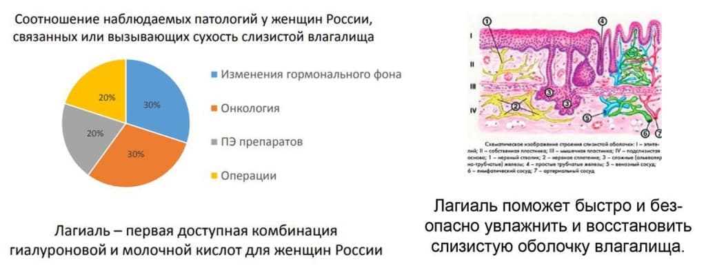Лагиаль свечи для чего. Смотреть фото Лагиаль свечи для чего. Смотреть картинку Лагиаль свечи для чего. Картинка про Лагиаль свечи для чего. Фото Лагиаль свечи для чего