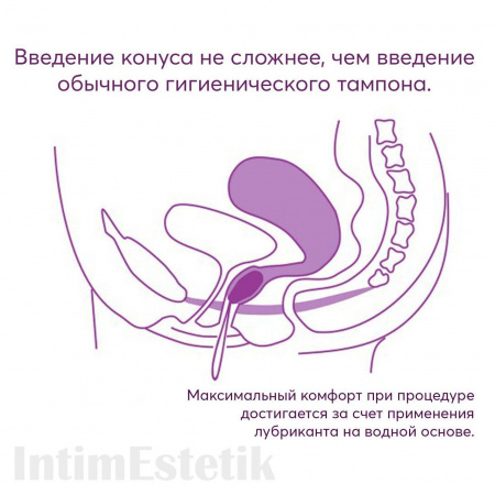 Влагалищные конусы Elanee Фаза 1